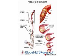 MF0220 3D chart图1