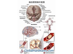 MF0219 3D Brain disease chart图1