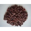 Purple Speckled Kidney Beans