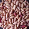 Light Speckled Kidney Bean (001)