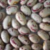 Light Speckled Kidney Beans - American Round