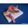 Normal Uterus Model (SMM274)