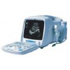 Portable Digital Ultrasound Diagnostic Scanner (C30)