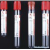 Vacuum Blood Collection Tube (Disposable Vacuum Tube) CE Approved